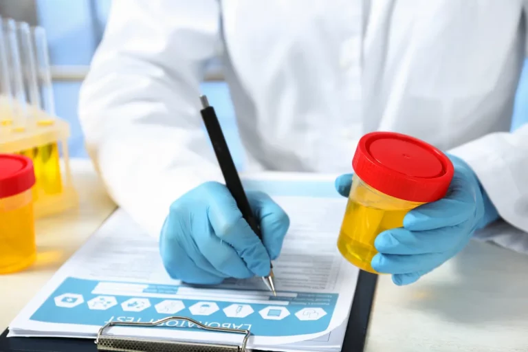 A collector documenting a sealed urine specimen on a chain-of-custody form